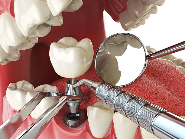 Best Walk-In Emergency Dental Services in Wellington, FL