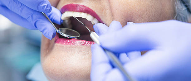 Best Dental Abscess Treatment in Wellington, FL